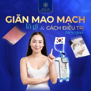 GIÃN MAO MẠCH LÀ GÌ? VÀ CÁCH ĐIỀU TRỊ HIỆU QUẢ
