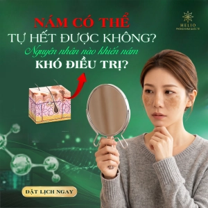 NÁM CÓ THỂ TỰ HẾT ĐƯỢC KHÔNG? NGUYÊN NHÂN NÀO KHIẾN NÁM KHÓ ĐIỀU TRỊ?