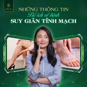 NHỮNG THÔNG TIN BỔ ÍCH VỀ BỆNH SUY GIÃN TĨNH MẠCH