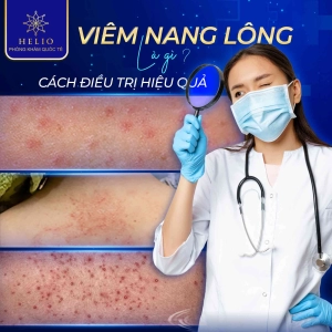VIÊM NANG LÔNG LÀ GÌ? VÀ CÁCH CHỮA TRỊ HIỆU QUẢ
