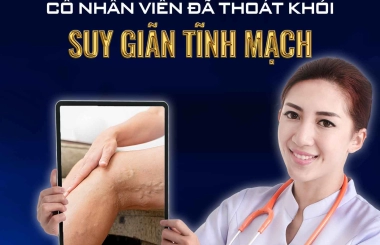 SUÝT BỊ LIỆT VÌ SUY GIÃN TĨNH MẠCH. ĐÂY LÀ CÁCH MÀ CÔ NHÂN VIÊN VĂN PHÒNG THOÁT KHỎI CĂN BỆNH NÀY