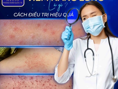 Là con gái, đừng để viêm nang lông ở lưng cản trở nàng diện những bộ đồ yêu thích, khoe dáng nuột nà