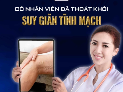 CHẤM DỨT SUY GIÃN TĨNH MẠCH MẠNG NHỆN CHỈ SAU 30 PHÚT ĐIỀU TRỊ